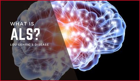 
James Yeager Illness: What Is ALS Disease? Symptoms And Health Update 